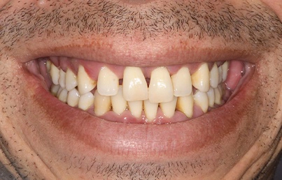 Smile gallary image - Before